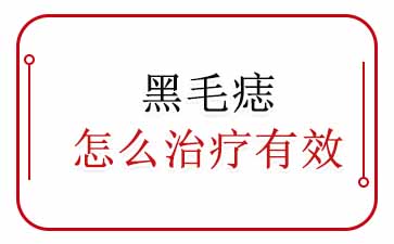 黑毛痣的治疗方法事什么