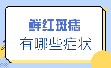 关于鲜红斑痣症状的介绍